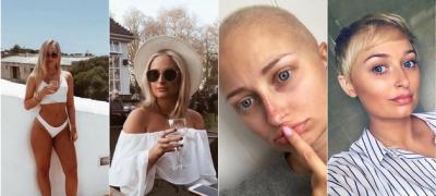 Pismo jedne 22-godišnje devojke koja se bori sa rakom: „Shvatite da je privilegija biti živ“