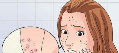 7 svakodnevnih navika kojima uništavate svoju kožu i izazivate akne