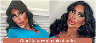 Kako izgleda žena koja je potrošila preko 180.000 evra na estetske korekcije? (foto)